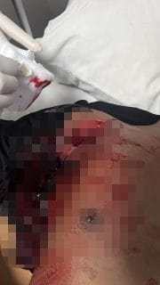 Sangkur Mencabut Damai, Empat Anggota Brimob Terluka dalam Bentrokan di Waemata