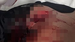 Sangkur Mencabut Damai, Empat Anggota Brimob Terluka dalam Bentrokan di Waemata
