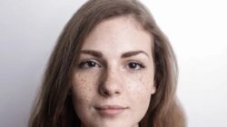 Cara Merawat Dermatitis Perioral dengan Rutinitas Skincare yang Tepat Cara Merawat Dermatitis Perioral dengan Rutinitas Skincare yang Tepat