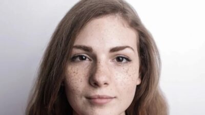Cara Merawat Dermatitis Perioral dengan Rutinitas Skincare yang Tepat Cara Merawat Dermatitis Perioral dengan Rutinitas Skincare yang Tepat