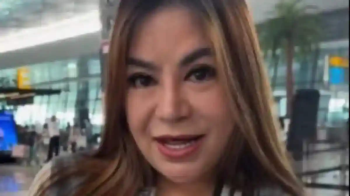 Anisa Bahar Cerita Lima Kali Operasi Hidung dan Biaya Revisi Terakhir